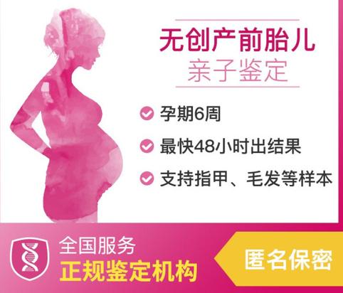 无创亲子鉴定能做